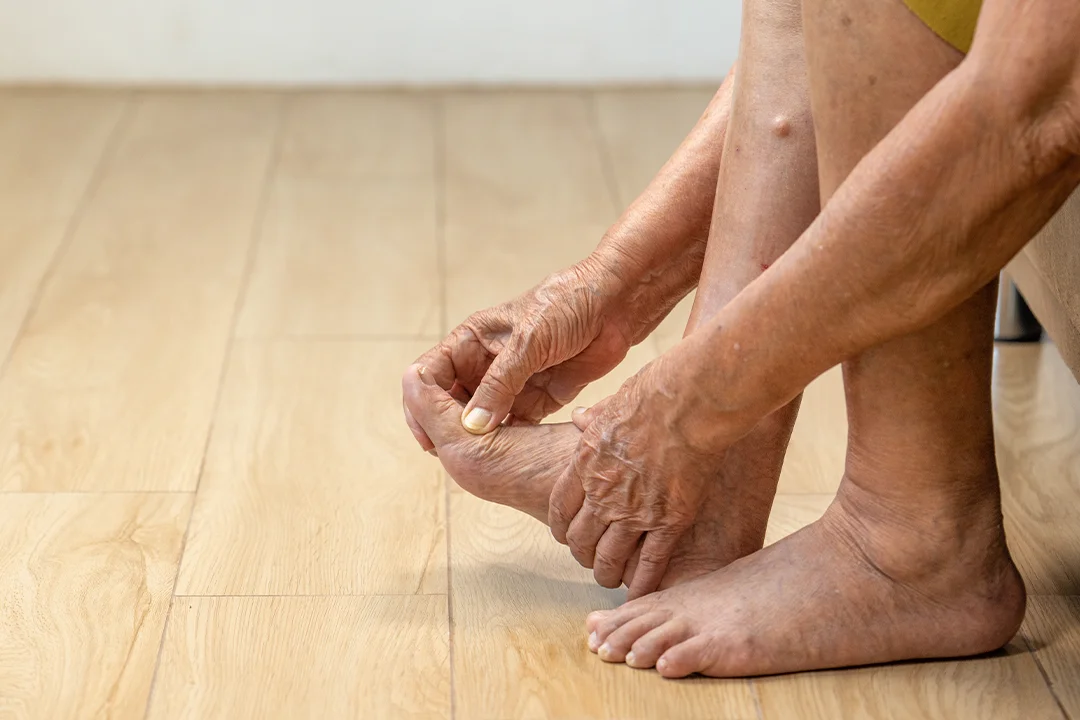 Foot-and-Ankle_0009_Elderly-woman-massage-her-foot-with-painful-swollen-gout-inflammation copy